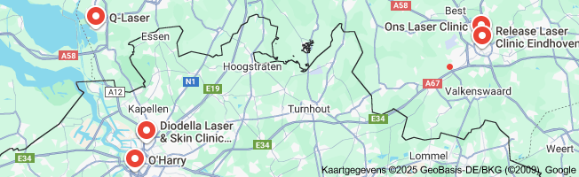 laseren
