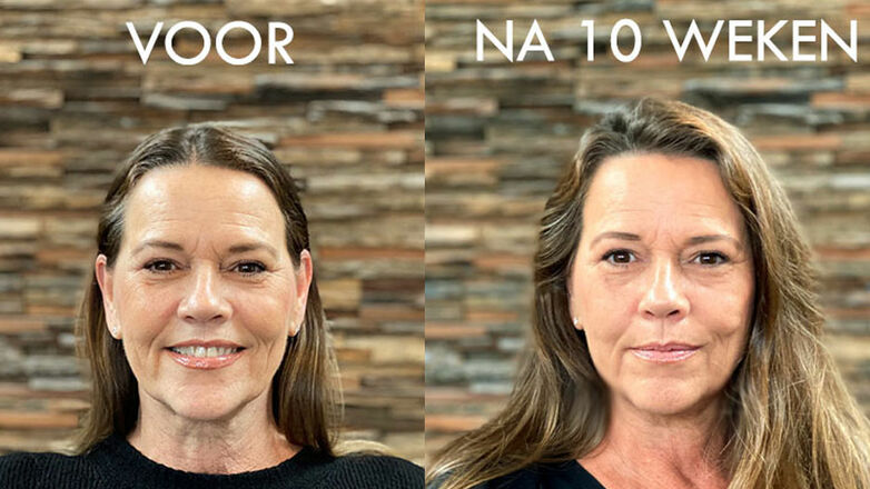 Hoe rimpels verminderen en een jeugdige uitstraling behouden: Tips en advies